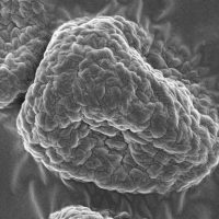 Scanning Electron Microscopy Aspergillus fumigatus spore