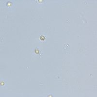 Ascospore Aspergillus fumigatus Ascospore Aspergillus fumigatus