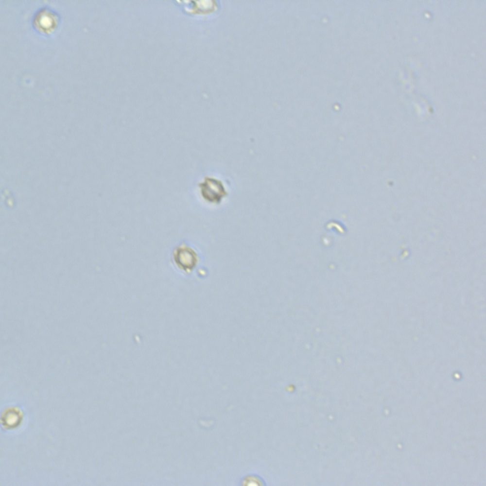 Ascospore Aspergillus fumigatus